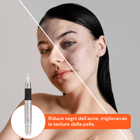 Dr. Fuchs Microneedling Rigenera Pelle Trattamento Rughe